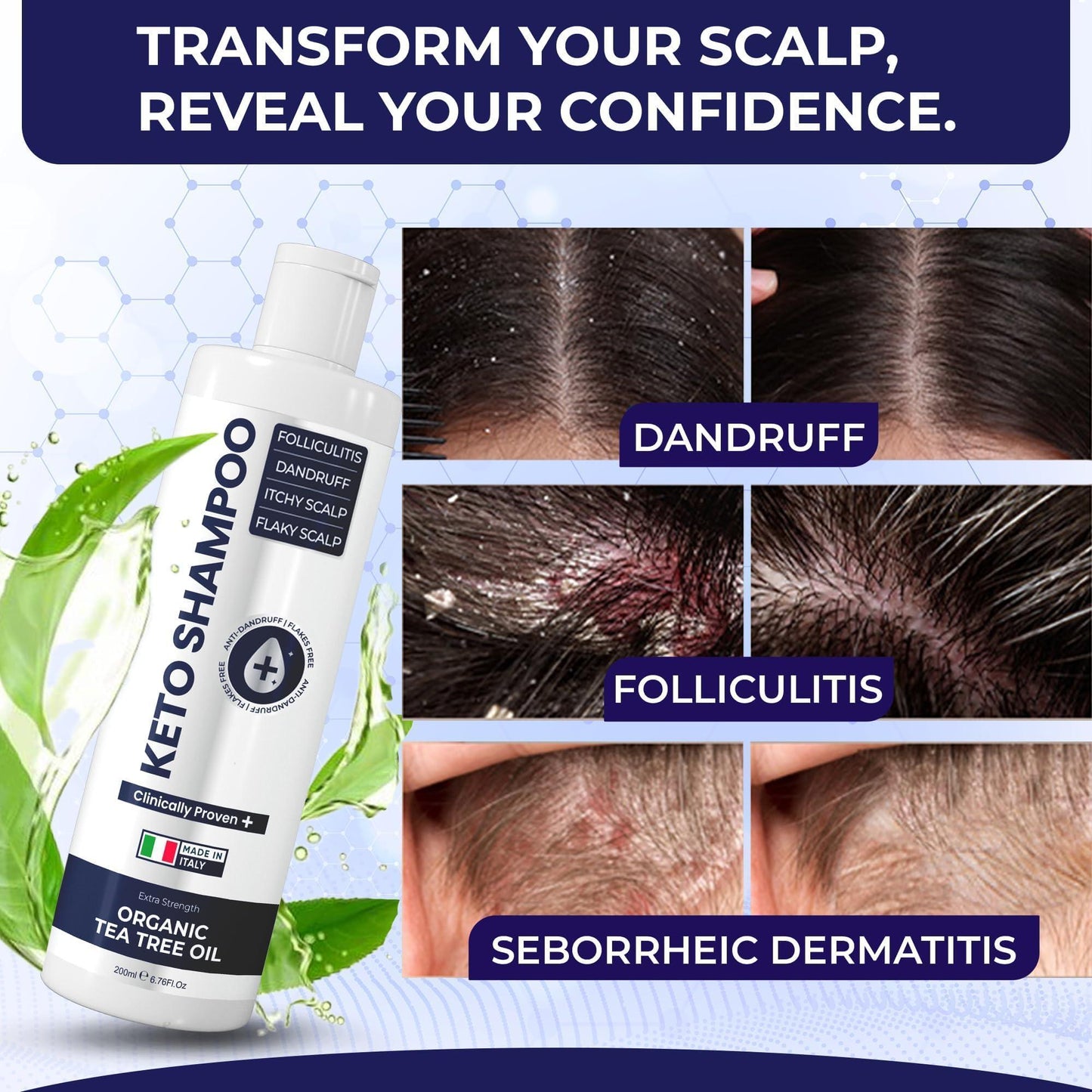 Medicated Scalp Shampoo - Anti-Dandruff & Itch Relief